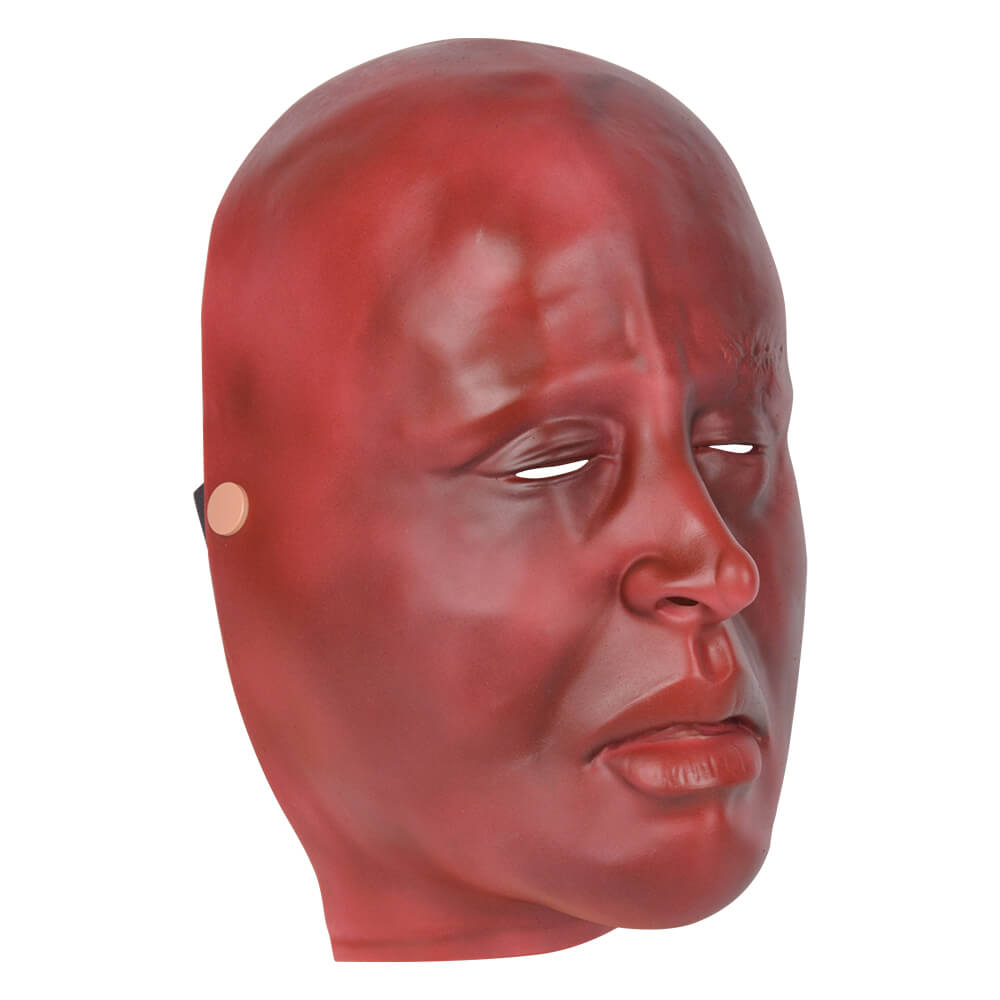 Wearable Facial Severe Burn Mask