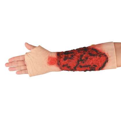 Severe Forearm Burn Simulation Sleeve