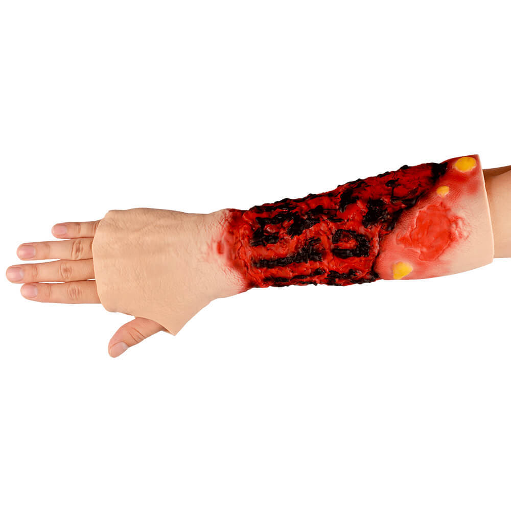 Severe Forearm Burn Simulation Sleeve