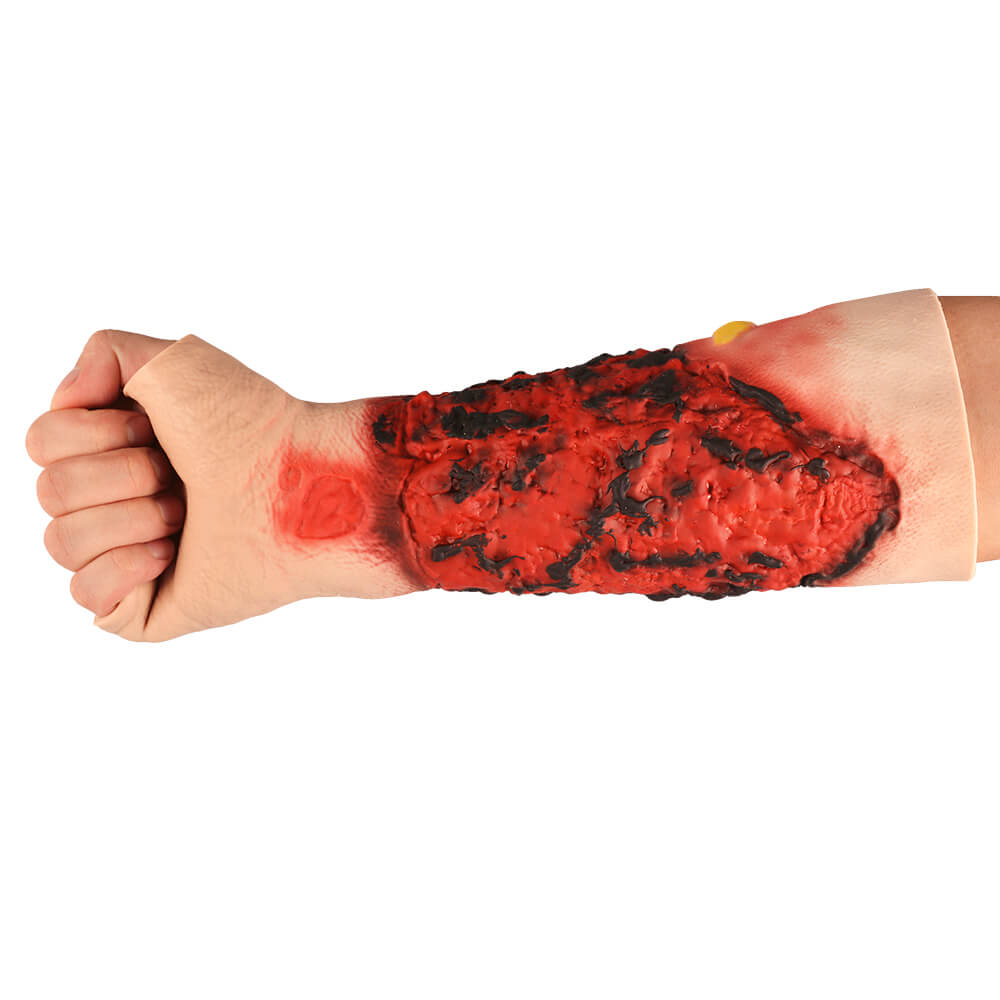 Severe Forearm Burn Simulation Sleeve