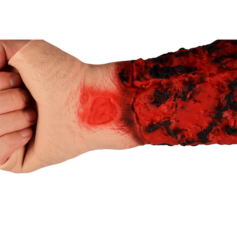 Severe Forearm Burn Simulation Sleeve