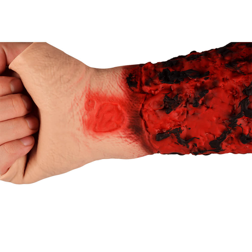 Severe Forearm Burn Simulation Sleeve