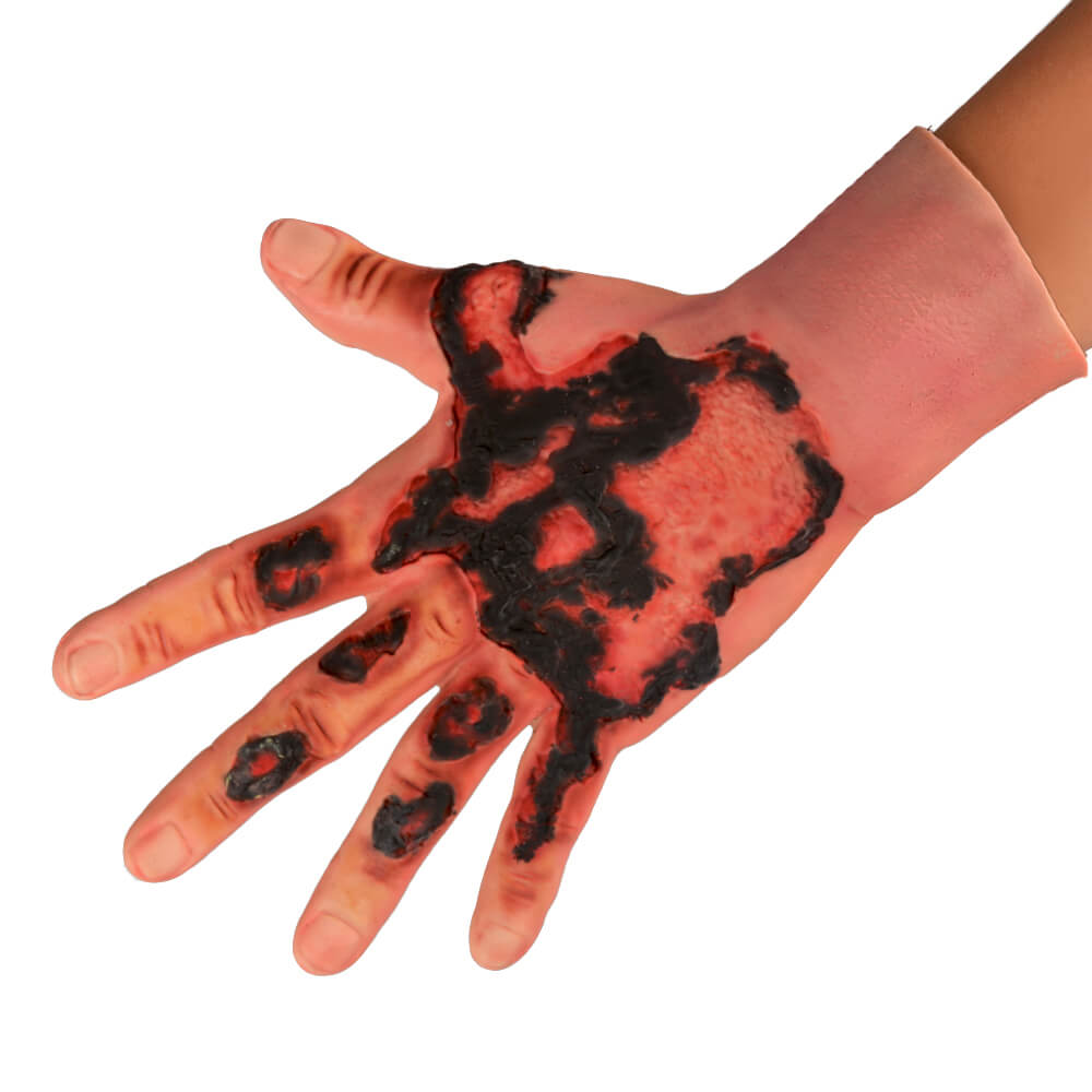 3rd Degree Hand Burn Simulation Glove