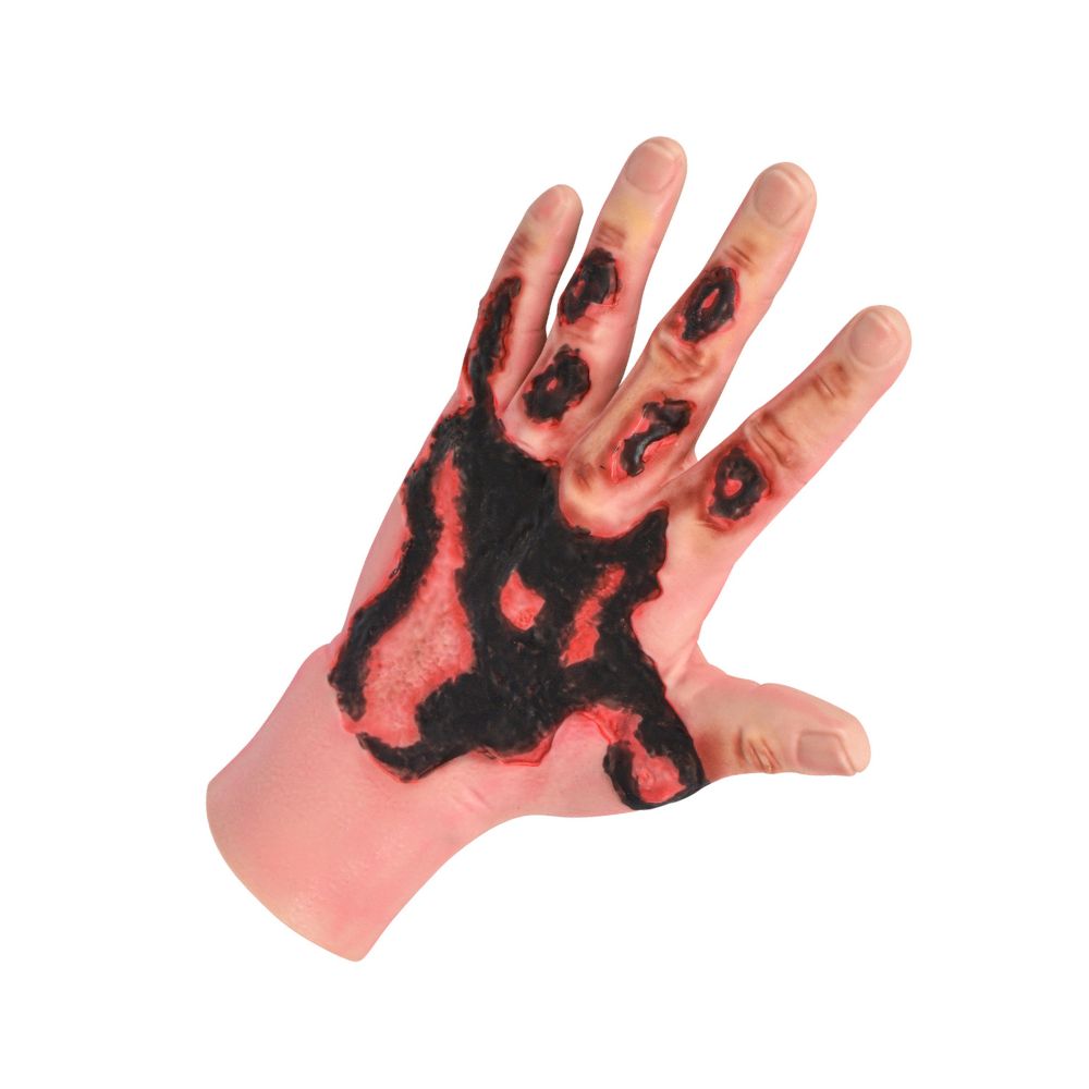 3rd Degree Hand Burn Simulation Glove