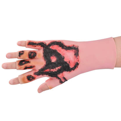 Severe Hand Burn Simulation Trainer (Silicone Glove-Style)