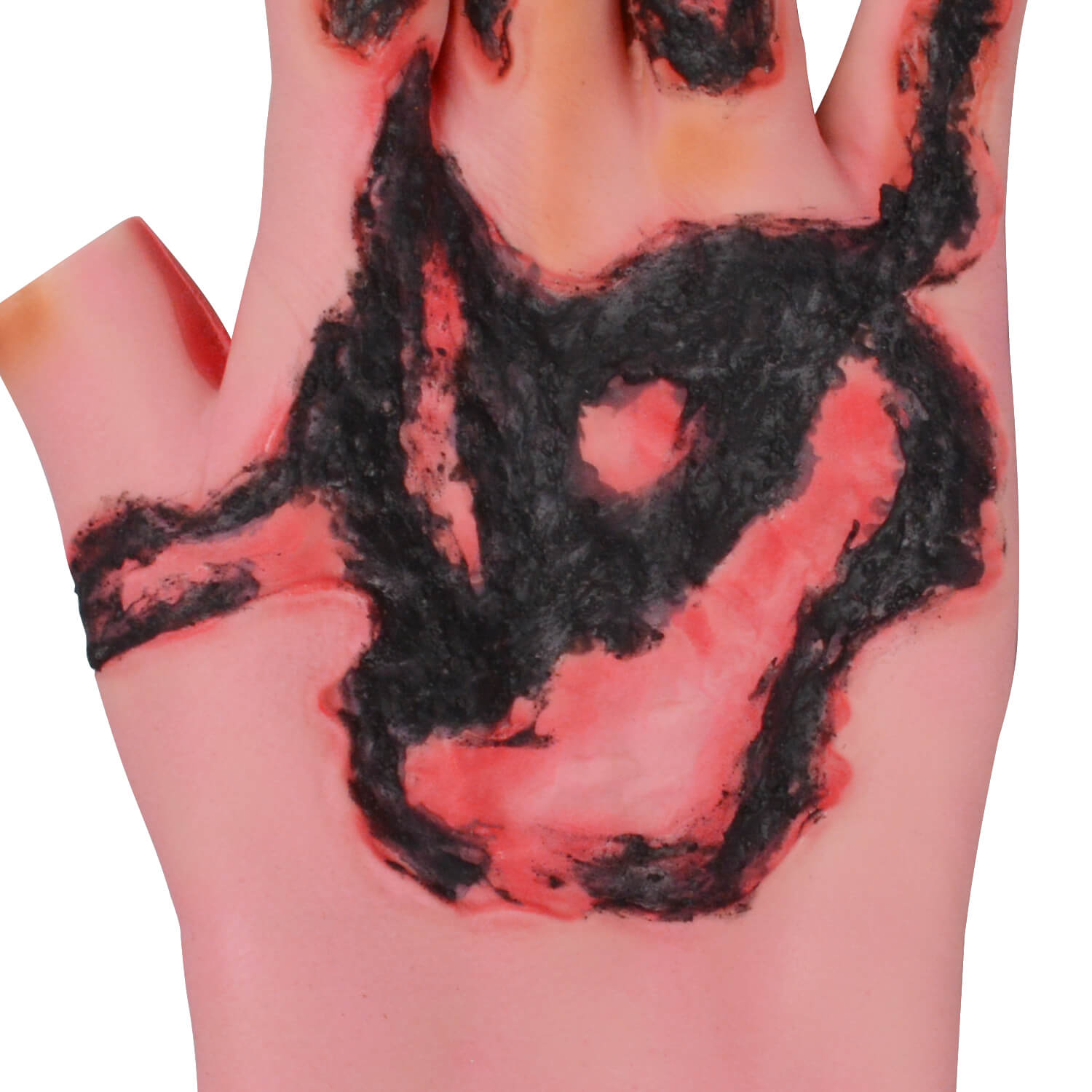 Severe Hand Burn Simulation Trainer (Silicone Glove-Style)