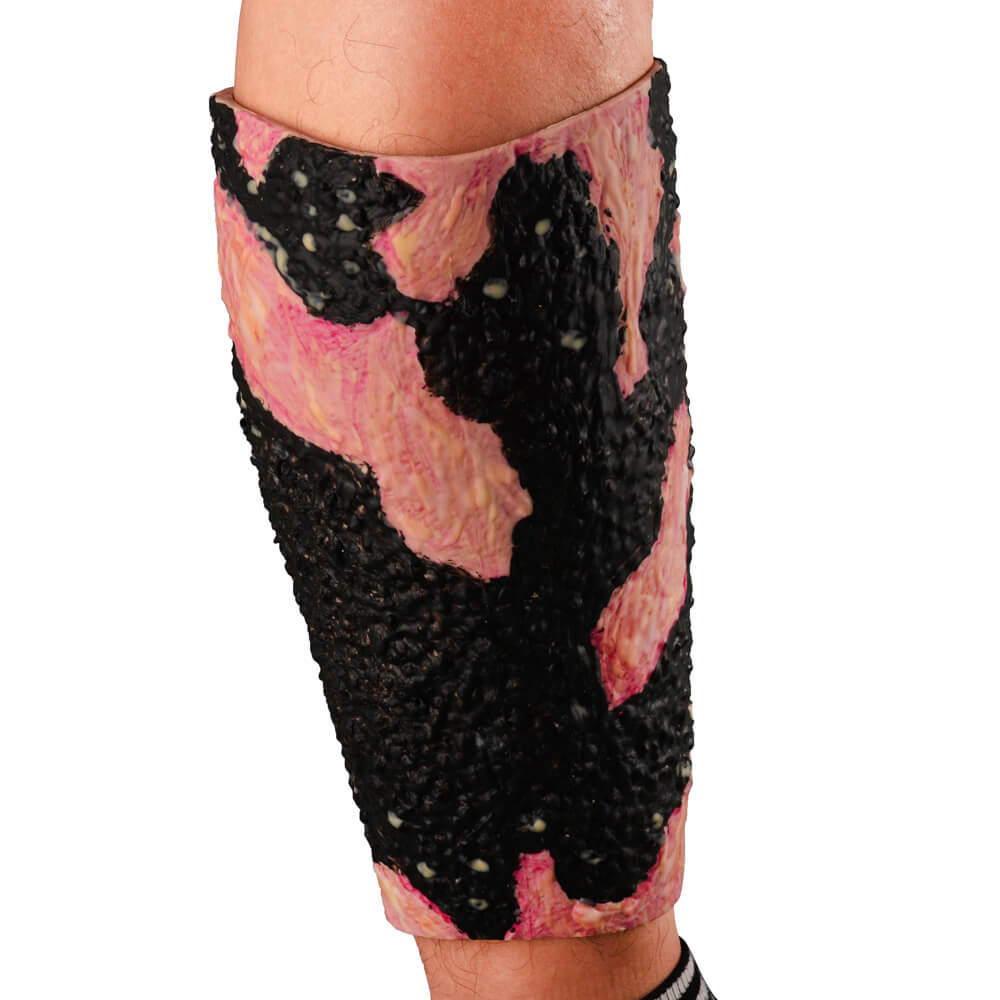 Severe Leg Burn Simulation Sleeve