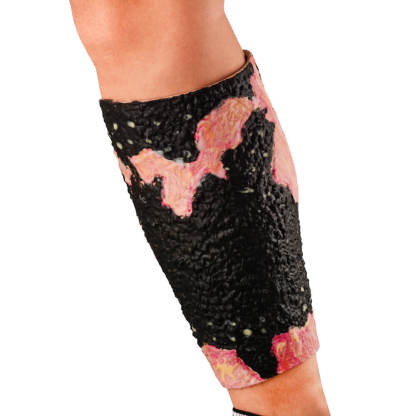 Severe Leg Burn Simulation Sleeve