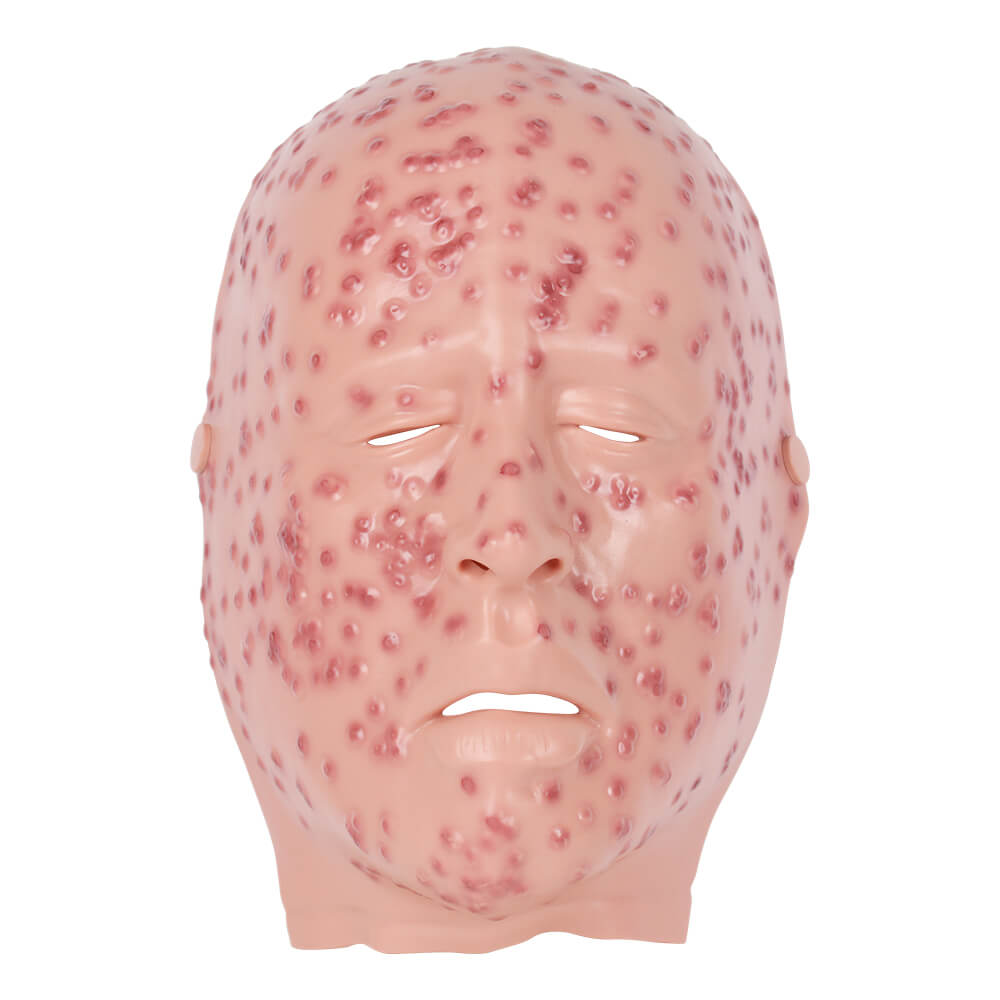 Severe Smallpox Facial Simulation Wound Training Mask