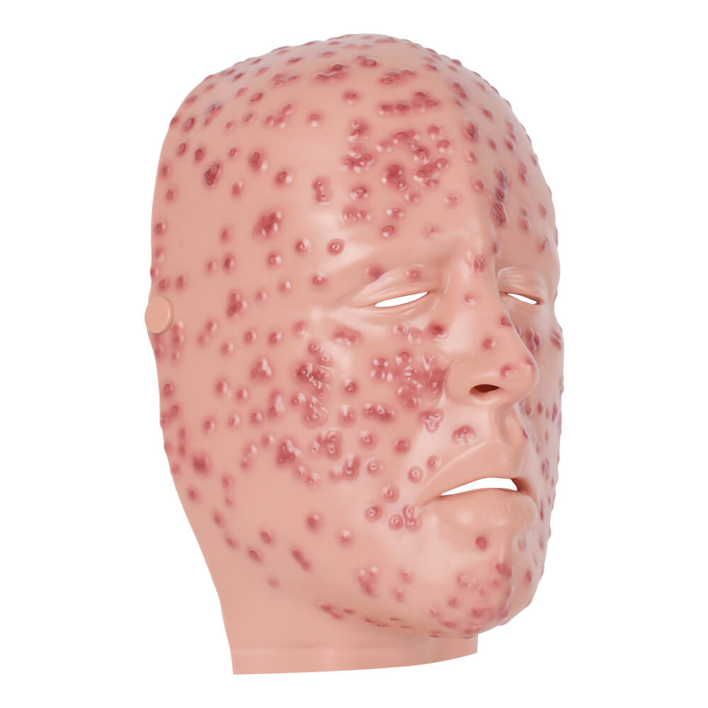 Severe Smallpox Facial Simulation Wound Training Mask