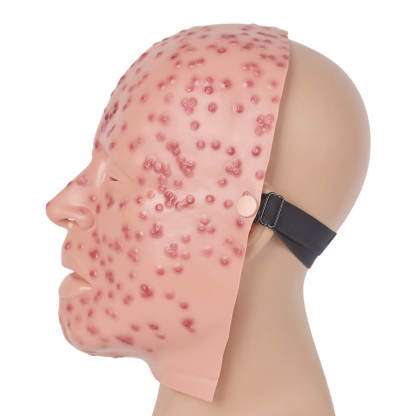 Full-Face Wearable Facial Severe Smallpox Model