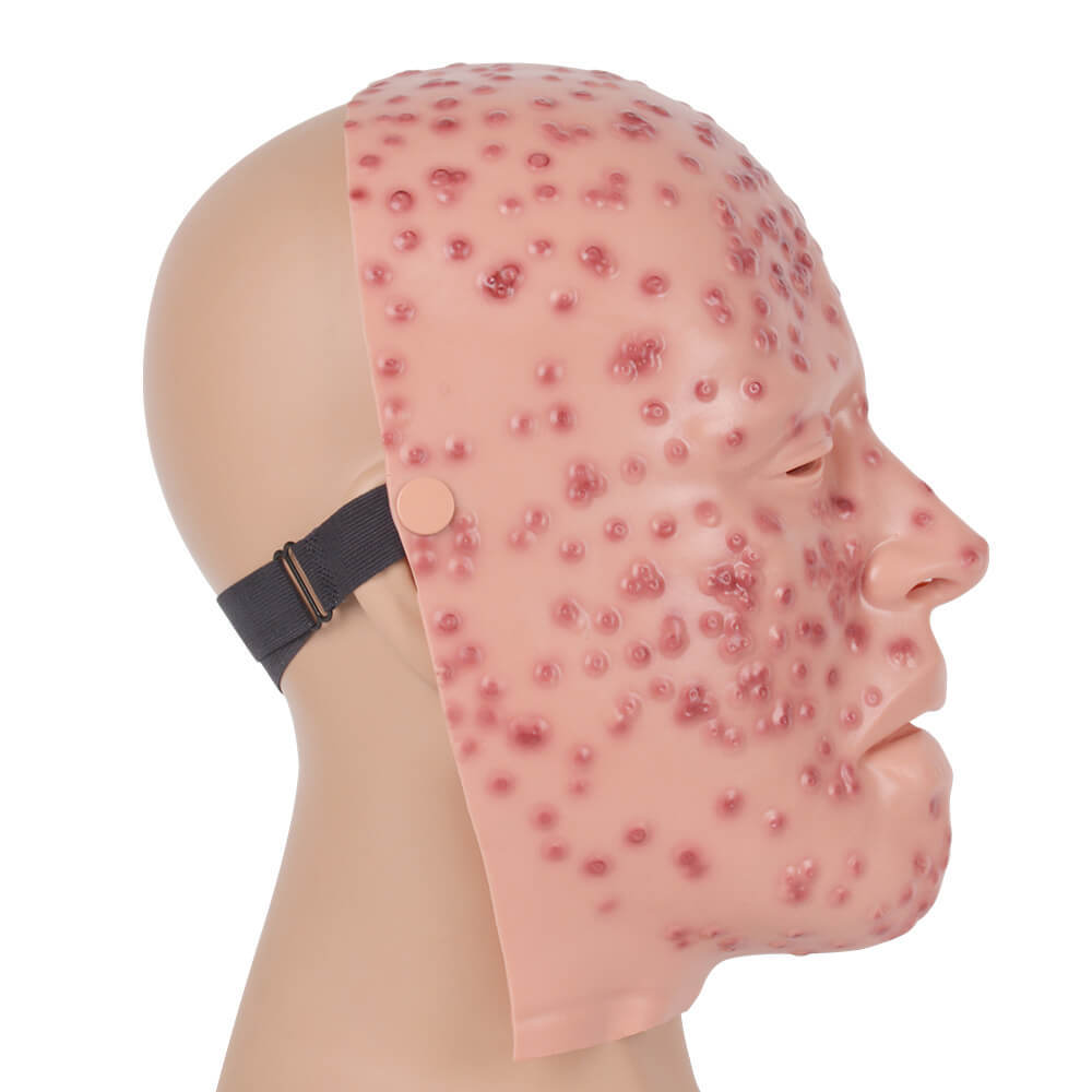 Wearable Facial Severe Smallpox Simulation Wound Model