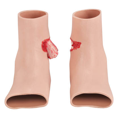 Wearable Ankle Open Fracture Trainer