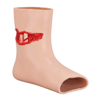 Wearable Ankle Open Fracture Simulator