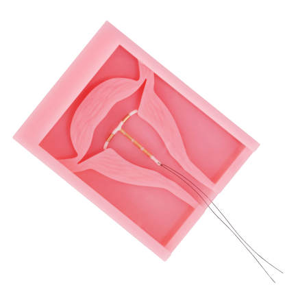 Square Silicone IUD Training Model