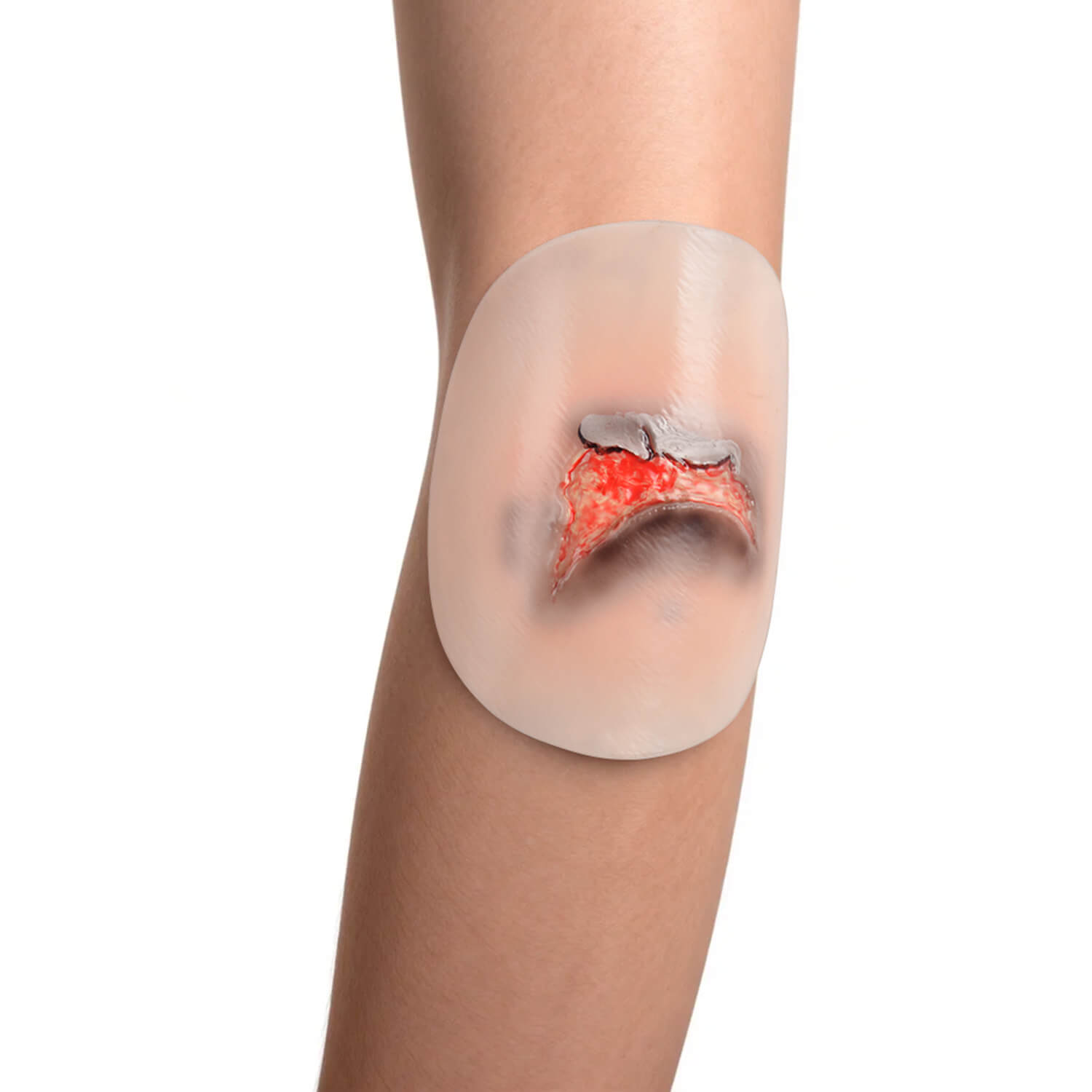 Silicone Skin Tear Simulation Models with Fragile Skin Flaps