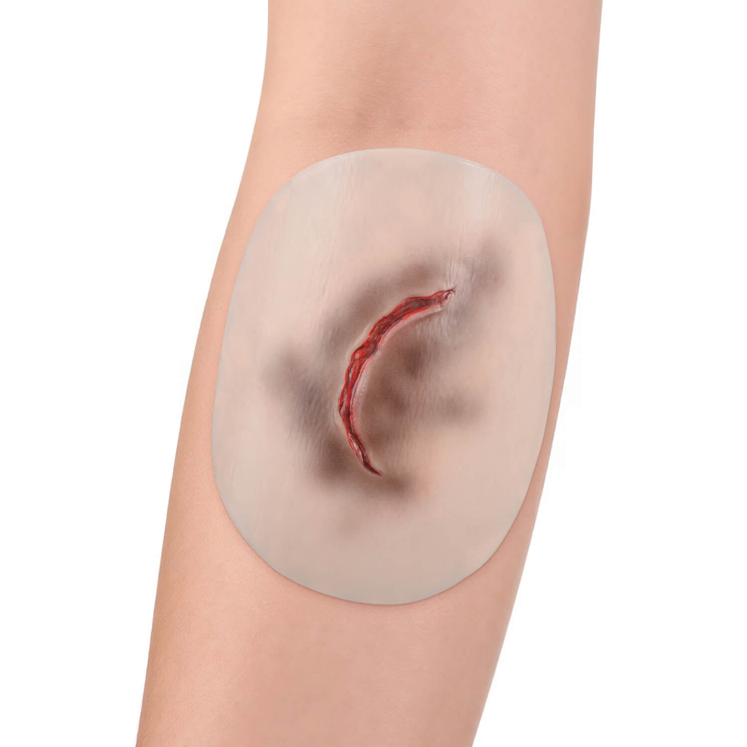 Adhesive Skin Tear Simulation Model Applied to Skin