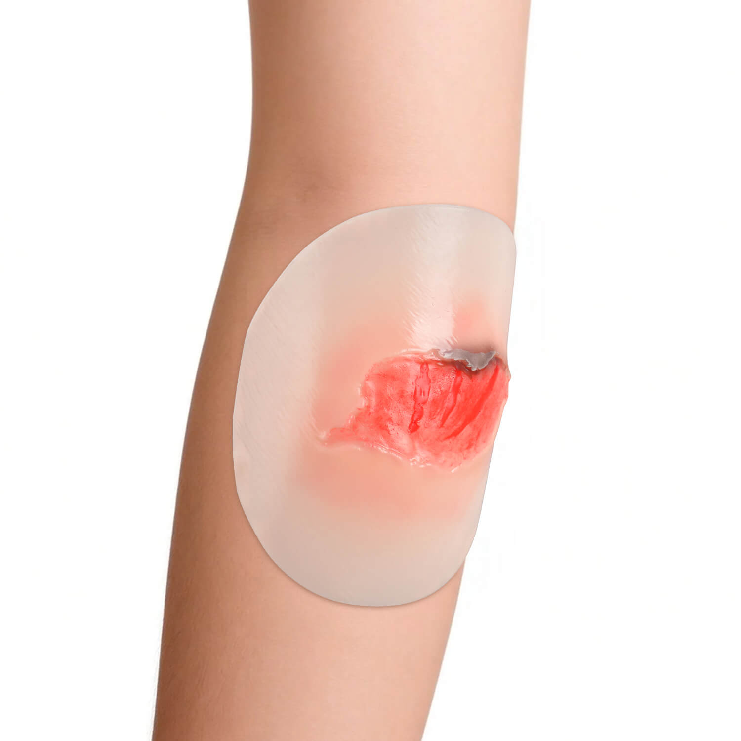 Realistic Silicone Skin Tear Models for Wound Assessment Training
