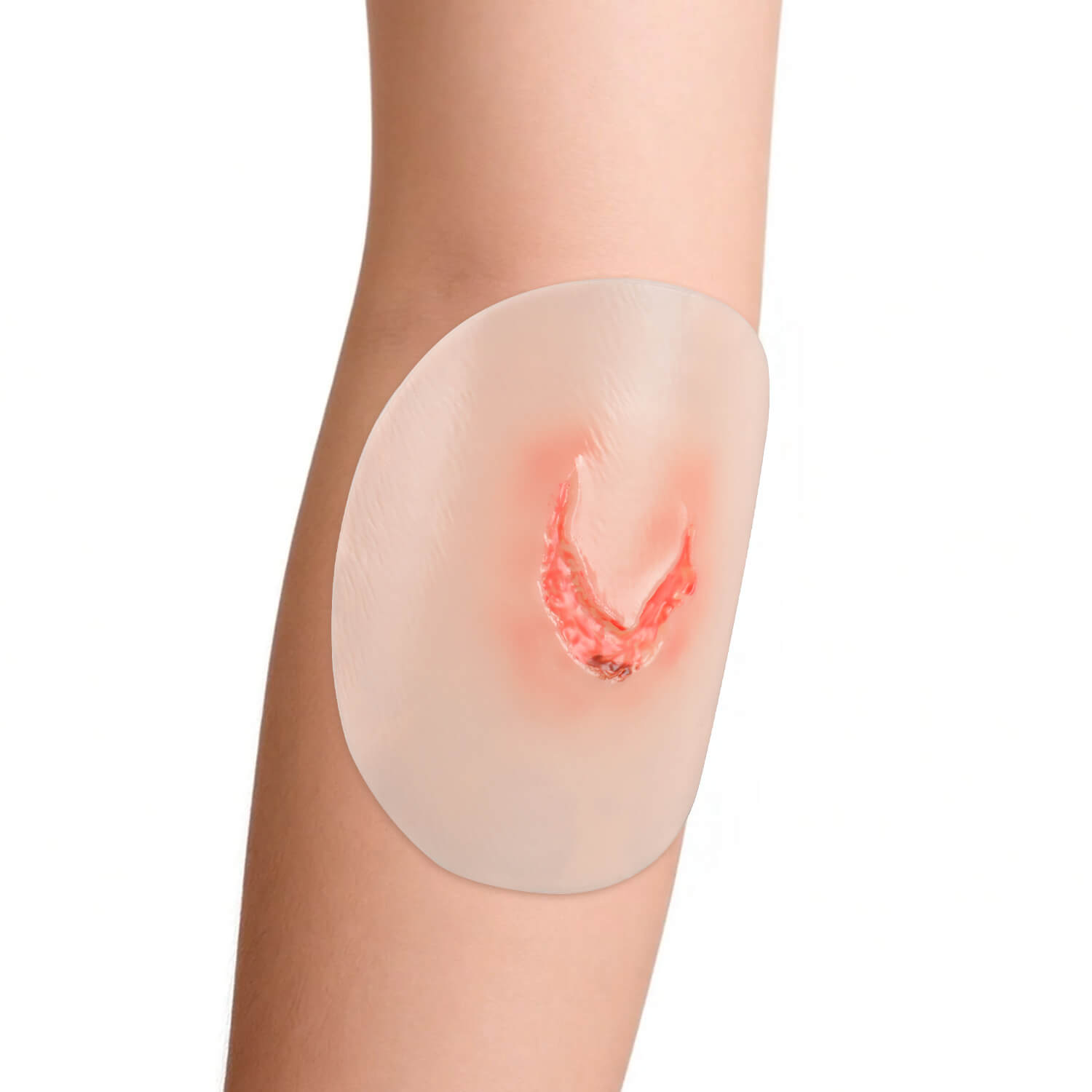 Adhesive-Backed Silicone Skin Tear Wound Models