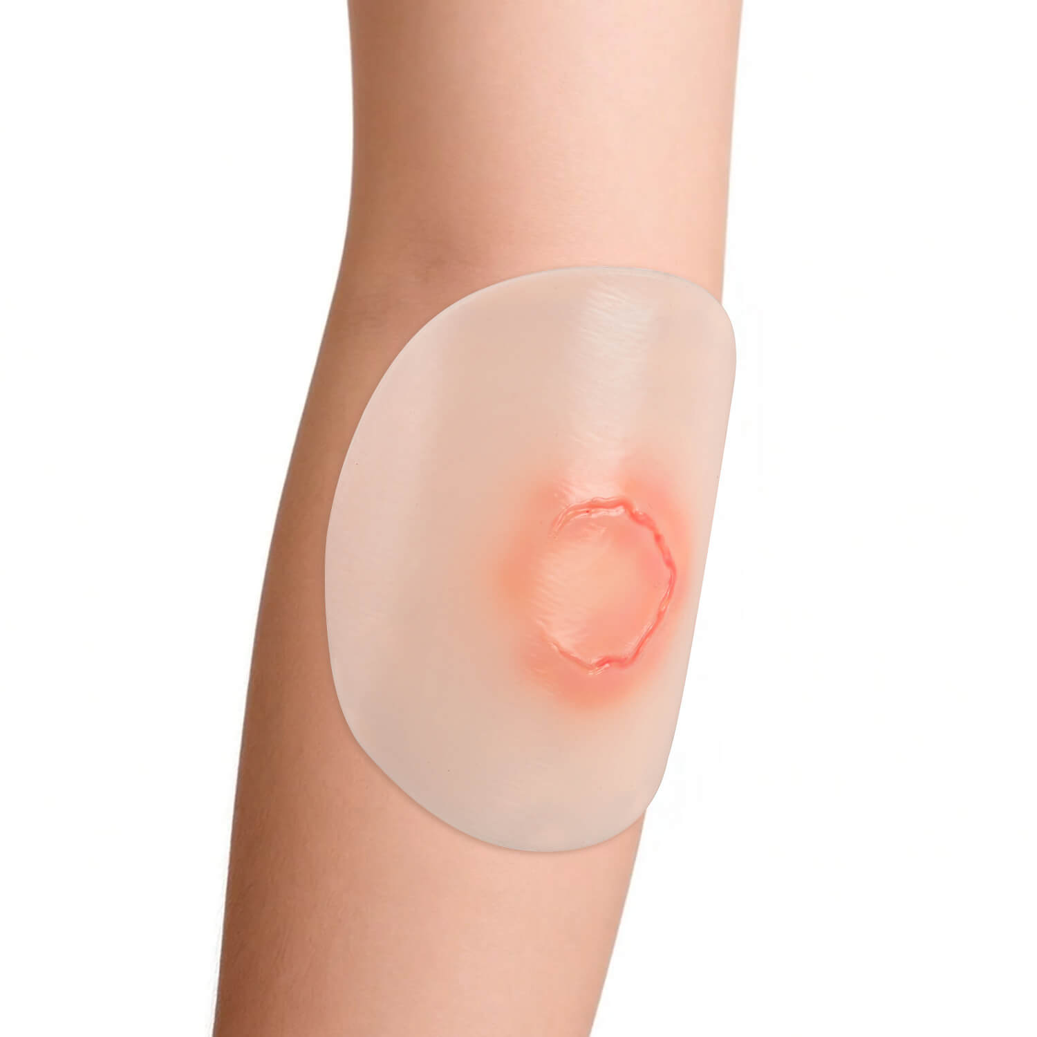 Five-Piece Silicone Skin Tear Simulation Models