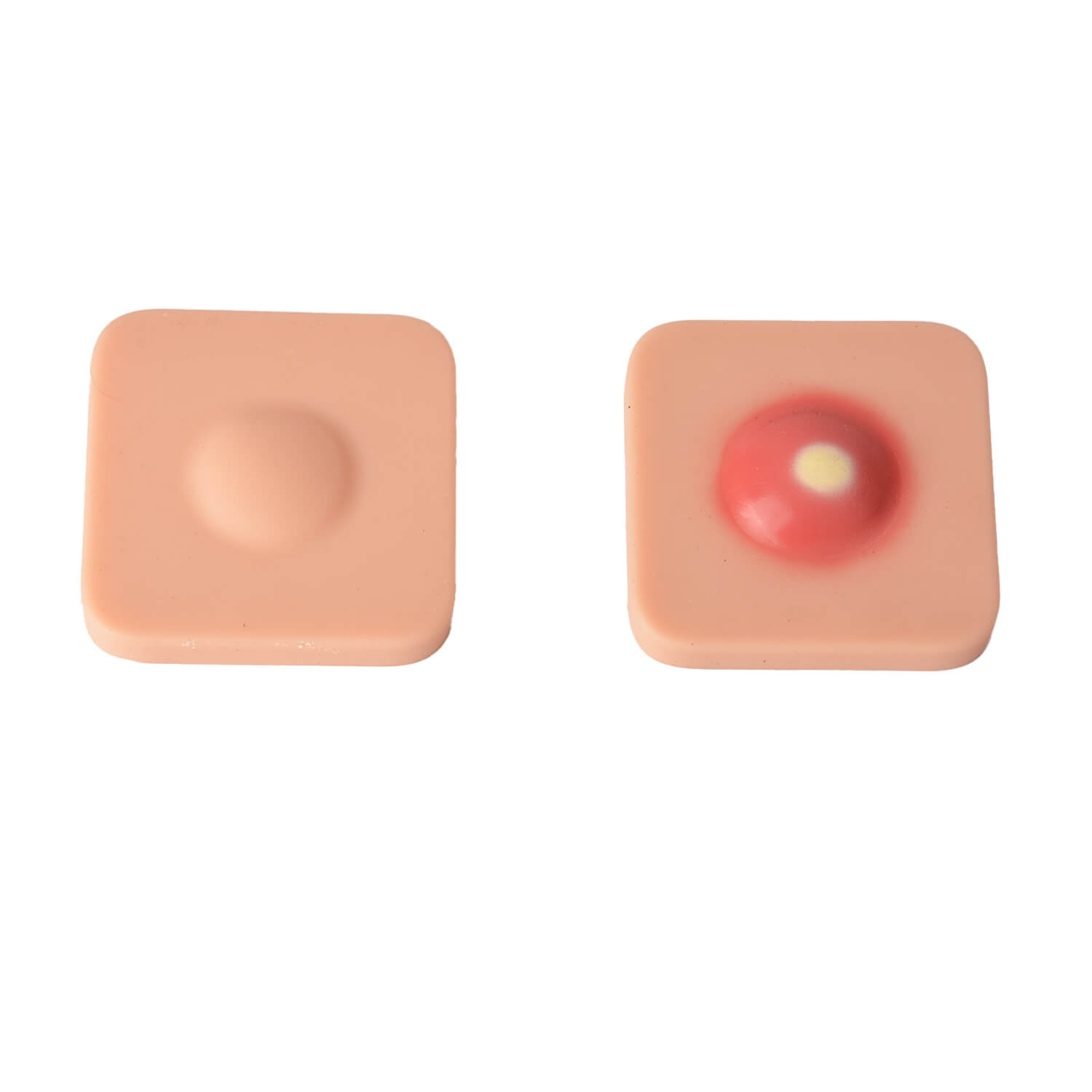 Ultrassist Abscess I&D Incision and Drainage Pad Trainer, Colored VS Colorless