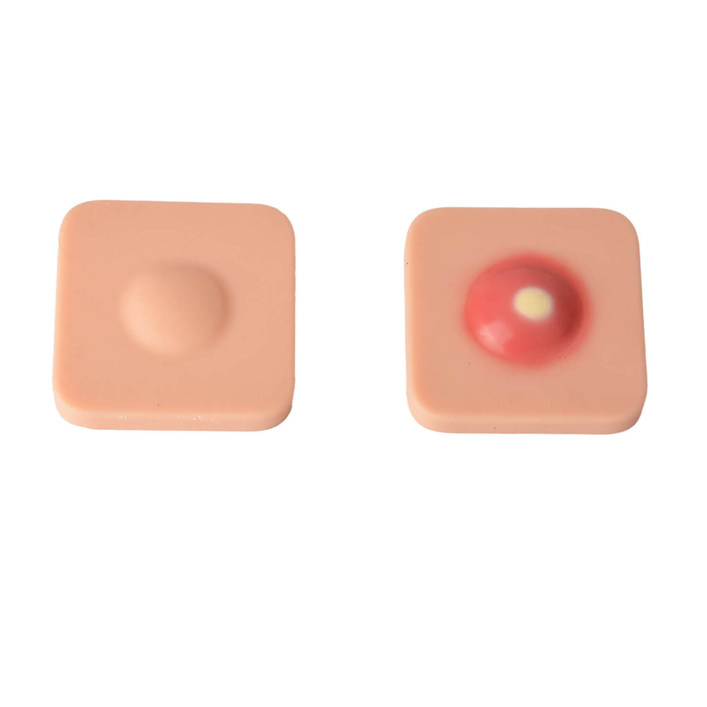 Ultrassist Abscess I&D Incision and Drainage Pad Trainer, Colored VS Colorless