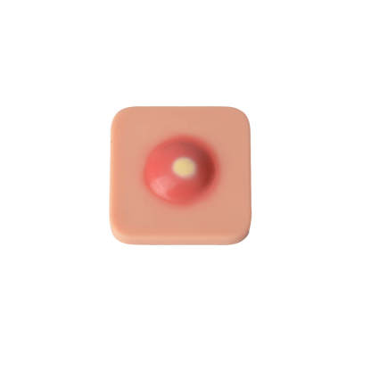 Ultrassist Abscess I&D Incision and Drainage Pad Trainer, One Piece
