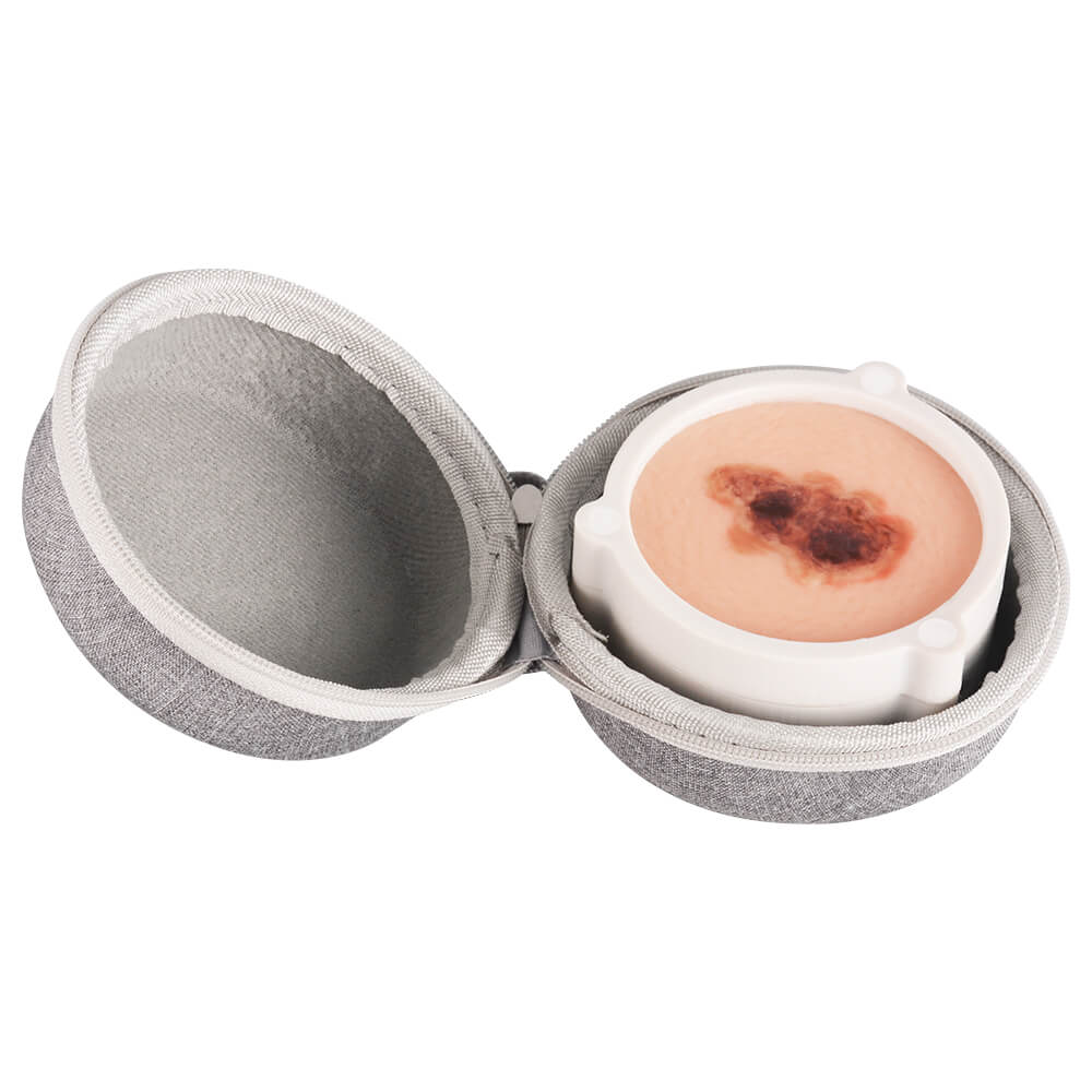 3-in-1 Magnetic Skin Cancer Model for Medical & Dermatology Education