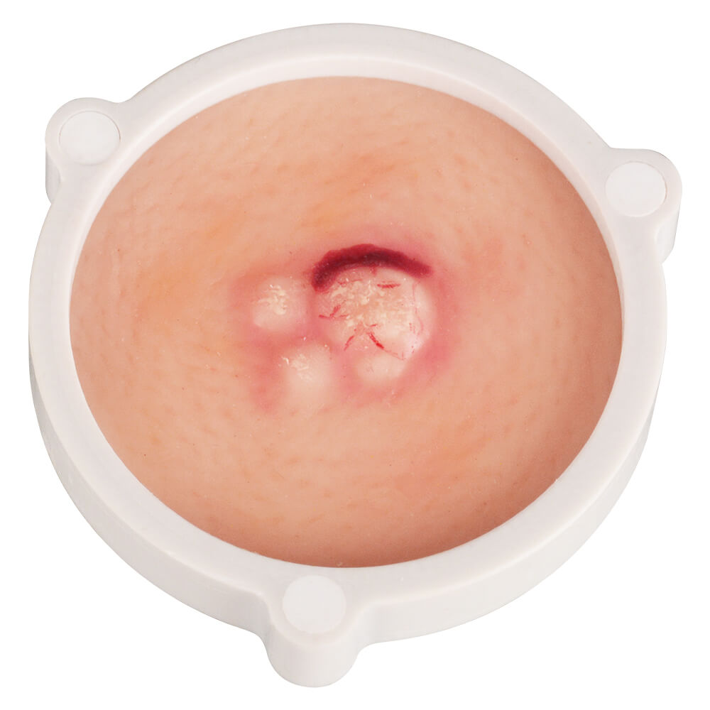 3-in-1 Magnetic Skin Cancer Model for Medical & Dermatology Education