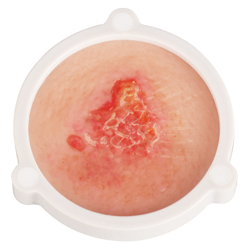 3-in-1 Magnetic Skin Cancer Model for Medical & Dermatology Education