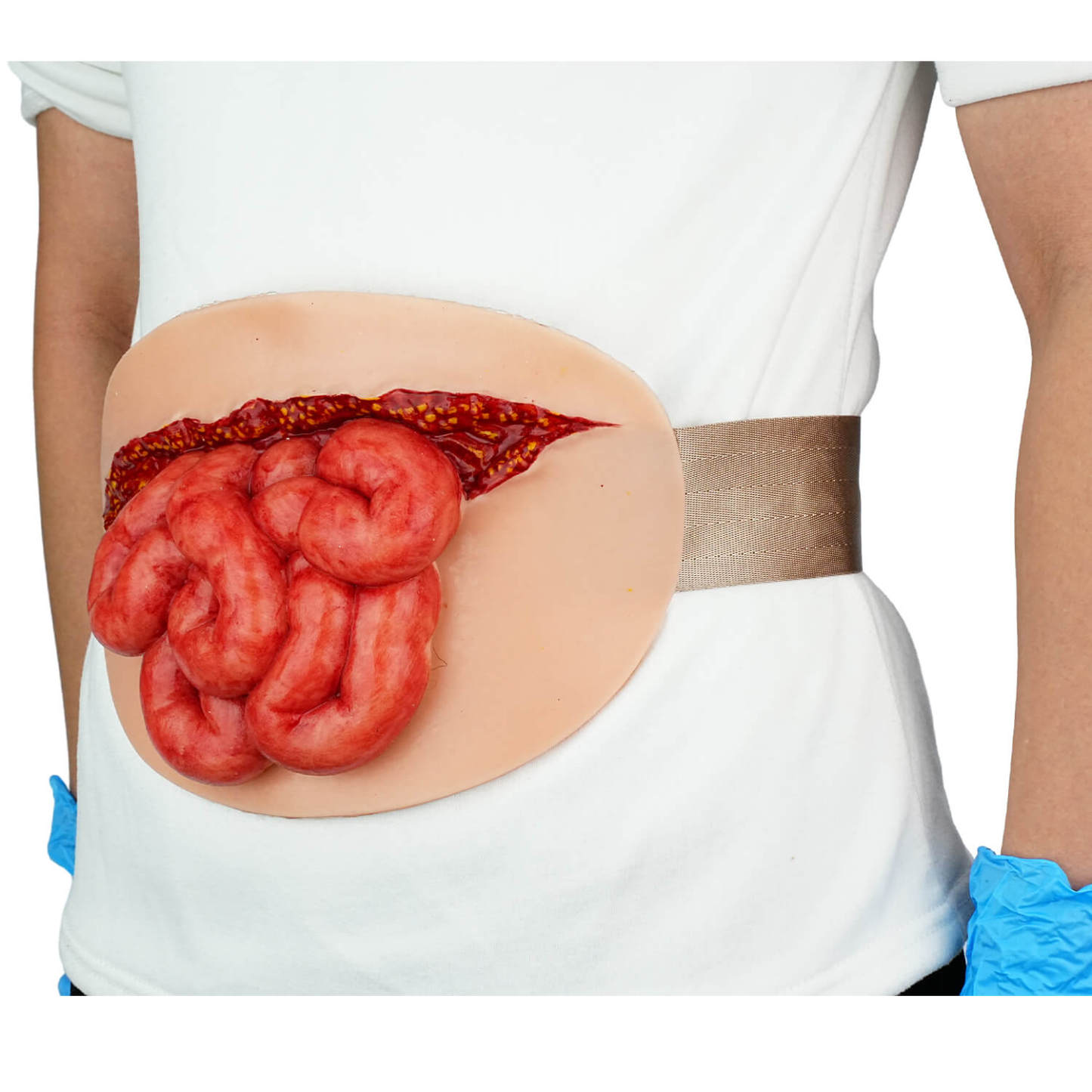 Wearable Abdominal Wound Small Bowel Evisceration 