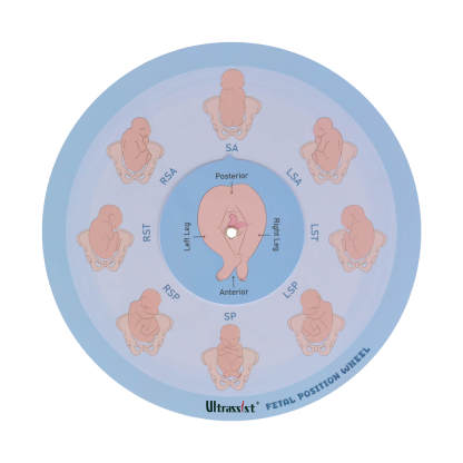 Midwife Fetal Position Tool - Cephalic & Breech