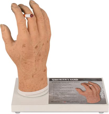 Ultrassist Smoker's Hand Model for Anti-Smoking Education