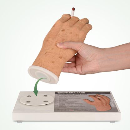 Ultrassist Smoker's Hand Model for Anti-Smoking Education