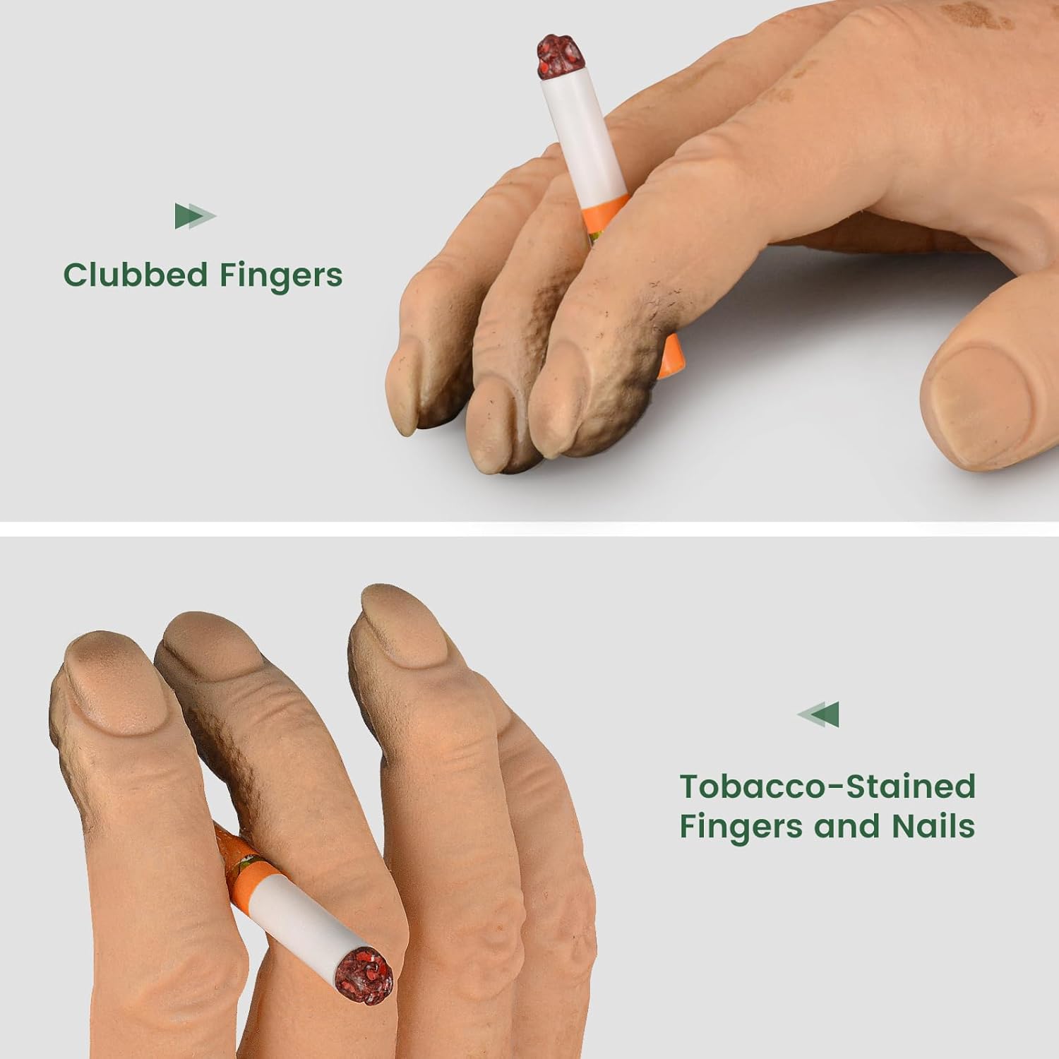tobacco stains off fingers Ultrassist Smoker's Hand Model for Anti-Smoking Education