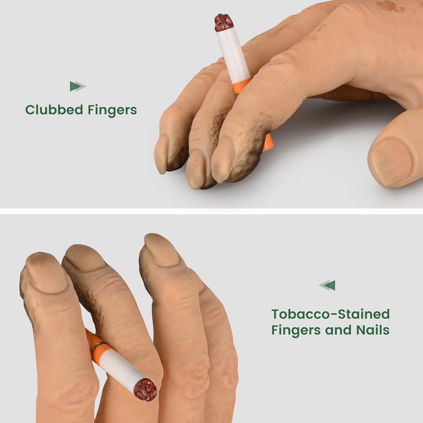 Ultrassist Smoker's Hand Model for Anti-Smoking Education