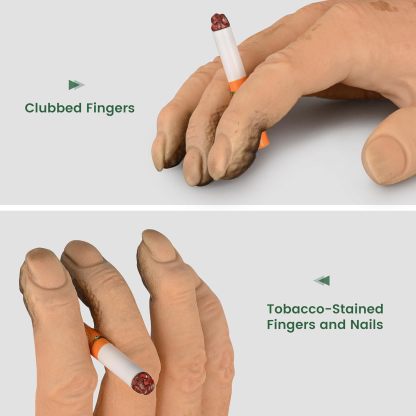 Ultrassist Smoker's Hand Model for Anti-Smoking Education