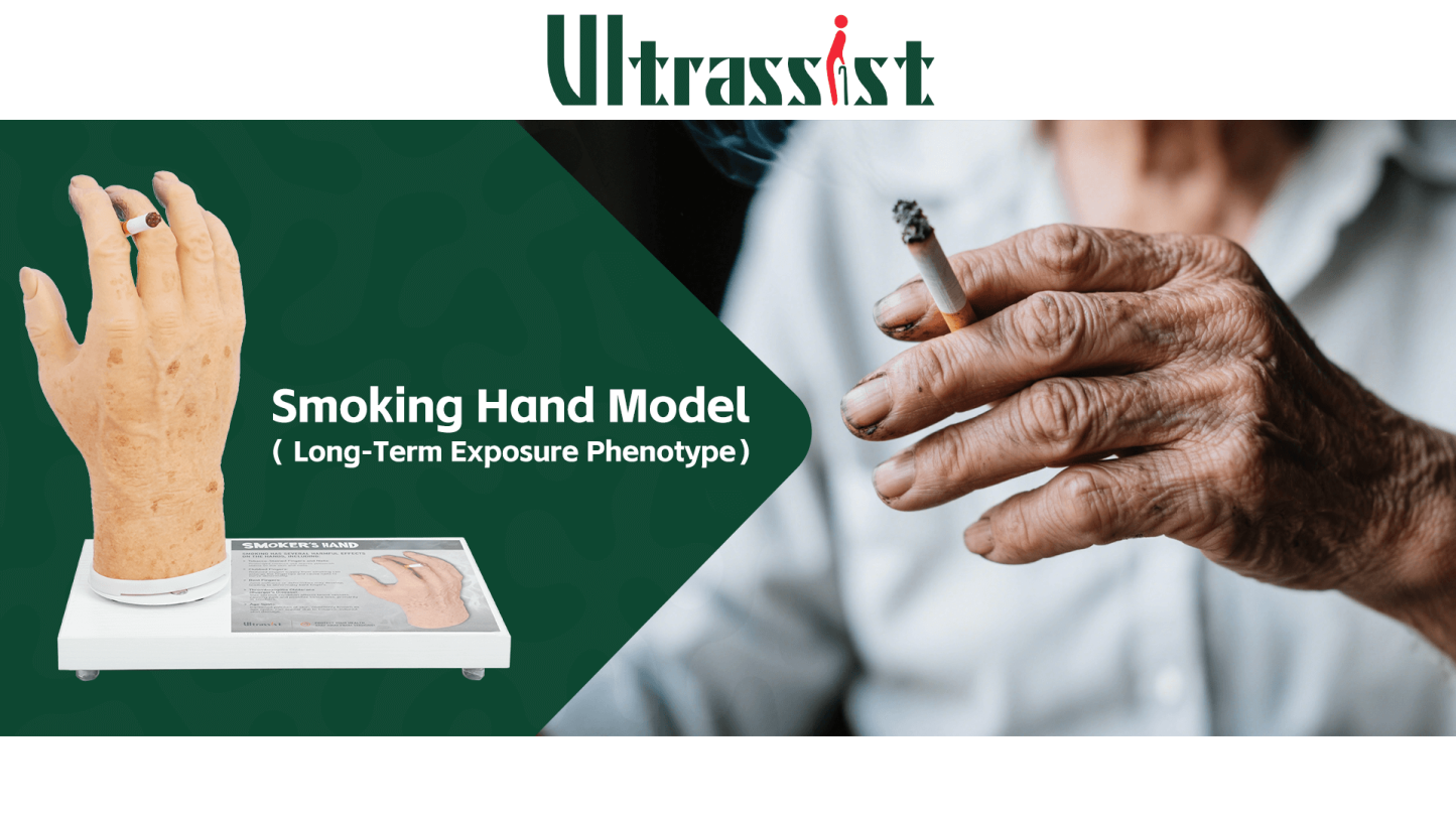 Ultrassist Smoker's Hand Model for Anti-Smoking Education