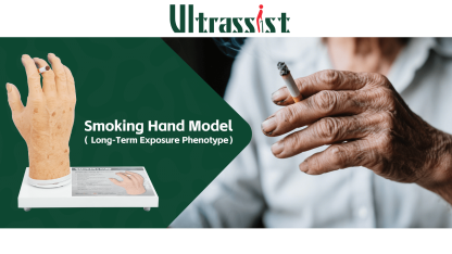 Ultrassist Smoker's Hand Model for Anti-Smoking Education