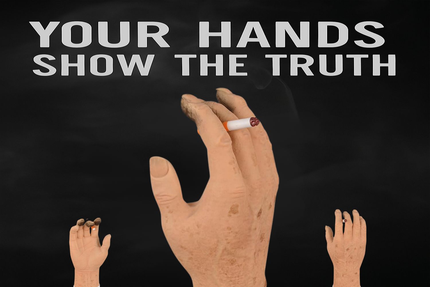 smoking damage on hand