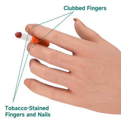 Female Smoking Hand Model with Ultra-Realistic Pathology Display