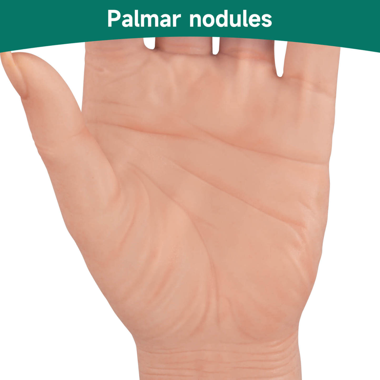 Female Smoking Hand Model with Ultra-Realistic Pathology Display
