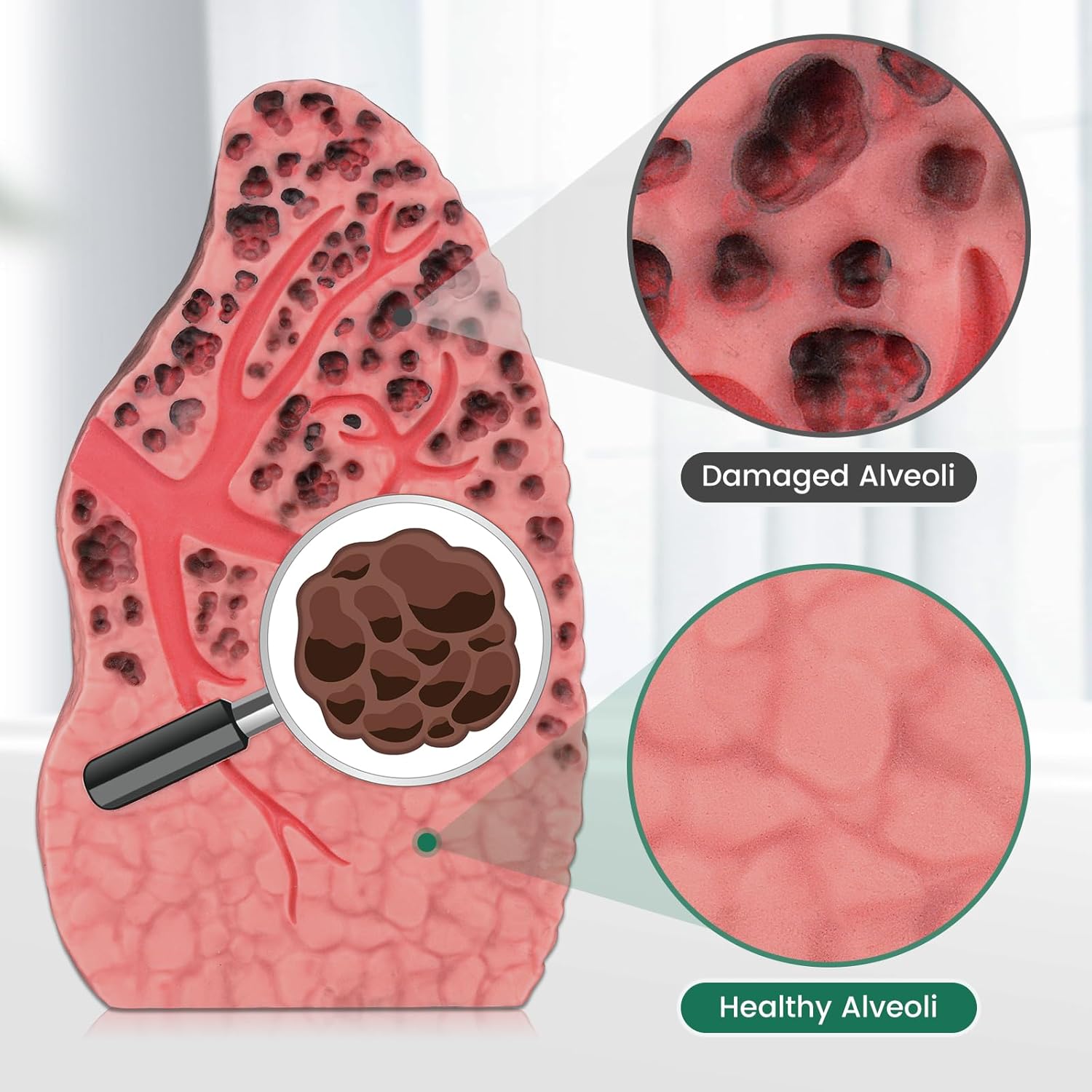 Ultrassist Cross-Sectional Smoking Lung Model – Realistic Tar Damage for Smoking Education