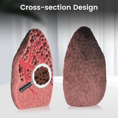 Ultrassist Cross-Sectional Smoking Lung Model – Realistic Tar Damage for Smoking Education