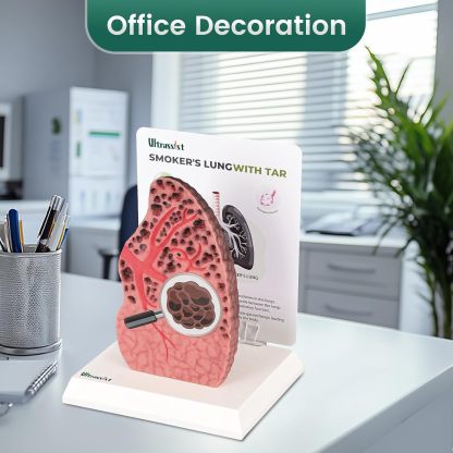 Ultrassist Cross-Sectional Smoking Lung Model – Realistic Tar Damage for Smoking Education