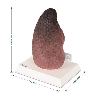 Ultrassist Cross-Sectional Smoking Lung Model – Realistic Tar Damage for Smoking Education