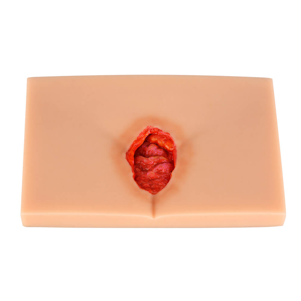4-Stage Decubitus Pressure Ulcer Wound Care Training Model Kit