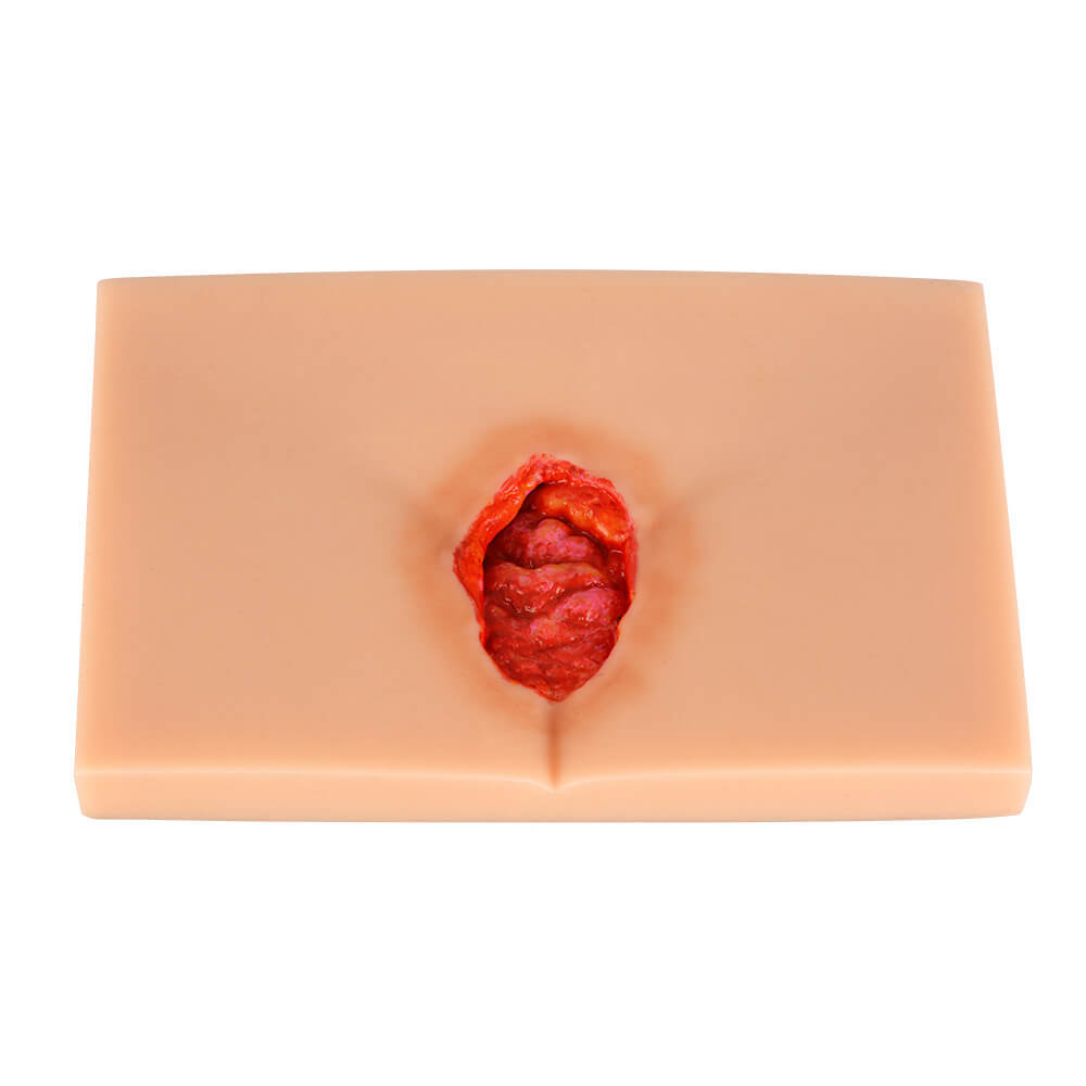 4-Stage Decubitus Pressure Ulcer Wound Care Training Model Kit