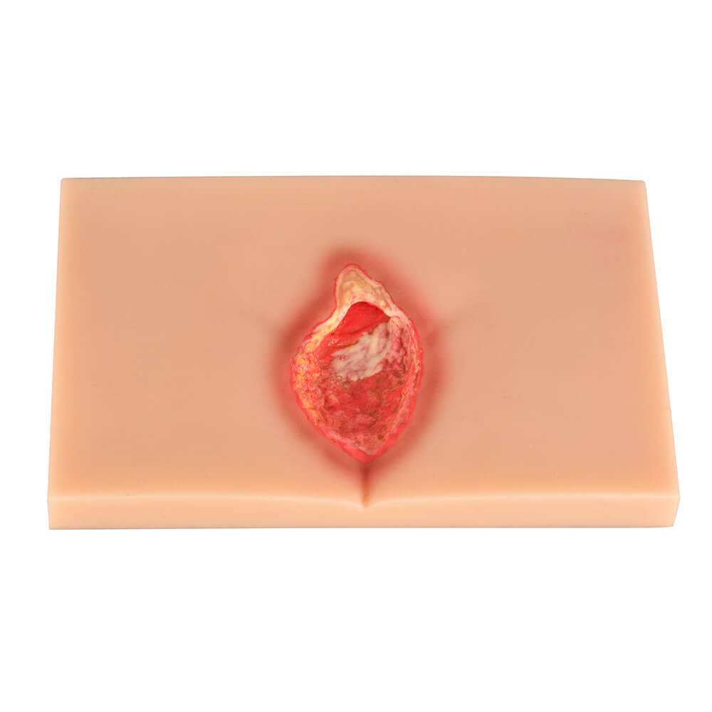 4-Stage Decubitus Pressure Ulcer Wound Care Training Model Kit