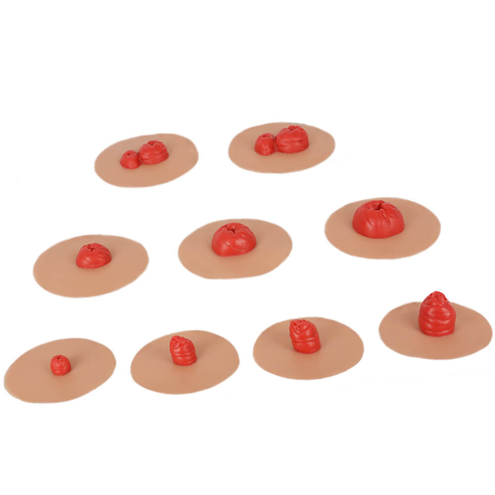 Sticky Ostomy Stoma Care Training Models Set